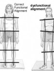 How Does Posture Alignment Therapy Work